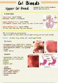 Gastrointestinal Bleeds - Summary Notes