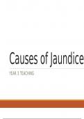 Causes of  Jaundice 