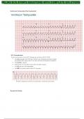 Portage Learning  NURS 4572 Relias ECG Strips Questions With Complete Solutions