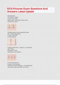 ECG Pictures Exam Questions And Answers Latest Update