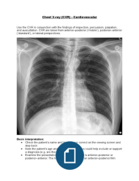 Chest X-ray (Cardiovascular)