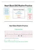 EKG Heart Blocks