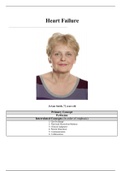 NURS MISC - CS Heart Failure- JoAnn Smith (Complete).