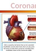 CORONARY HEART DISEASE SUMMARY