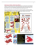Sickle cell 
