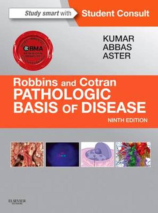 Molecular Basis of Cancer - Pathological basis of disease